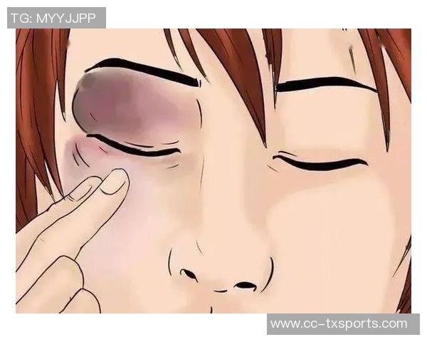 小卡解释鼻子出血原因只是轻微划伤并遭遇眼部意外碰撞